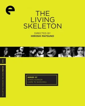 The Living Skeleton